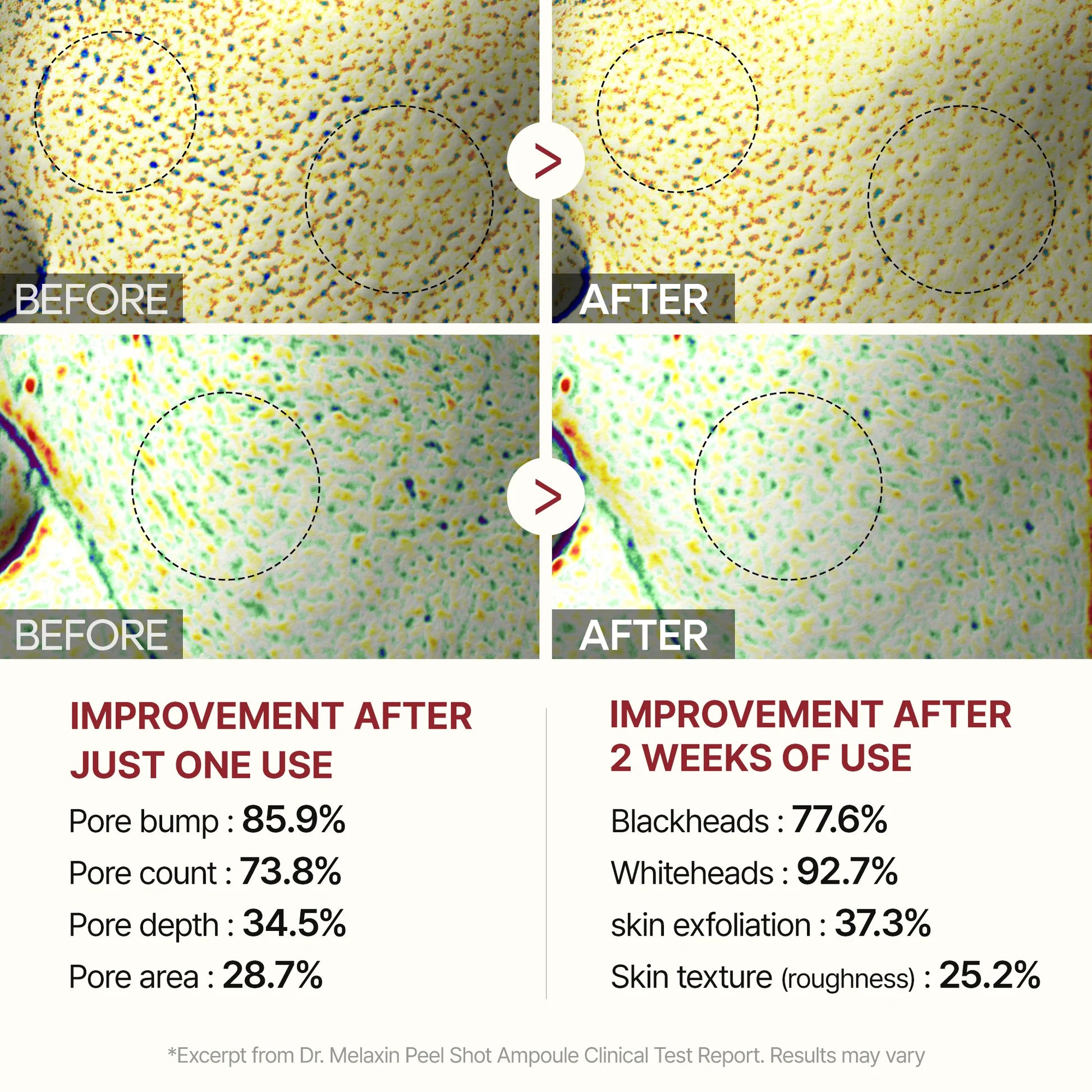 Peel Shot Glow Rice Line