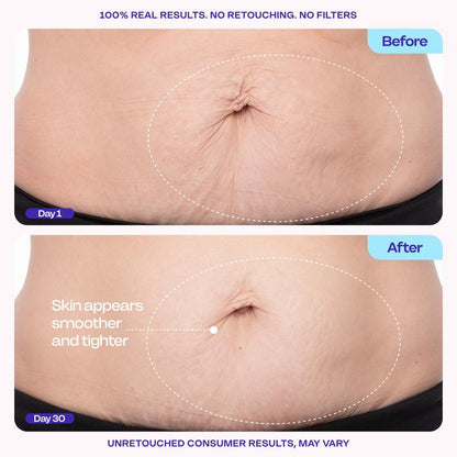 New! GOPURE Tighten & Smooth Belly Firming Cream