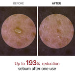 Peel Shot Glow Rice Line